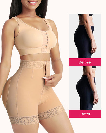 Elevate Your Shape: Lily™ Tummy Control Shapewear Shorts